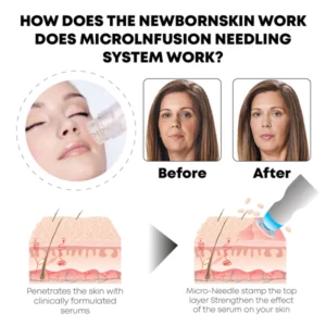 BabySkin MicroInfusion AgelessSystem