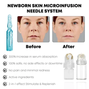 BabySkin MicroInfusion AgelessSystem