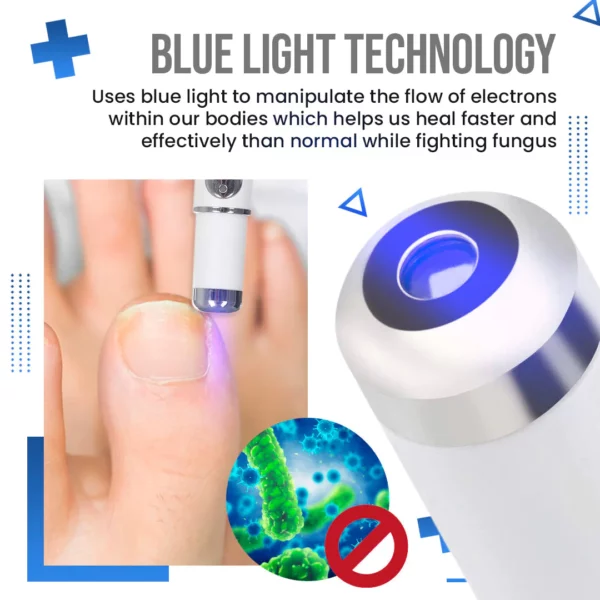 BioLab™ Anti Fungus Blue Light Laser Pen - Image 7