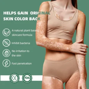 Canada Polumna™ Vitiligo Relief Spray