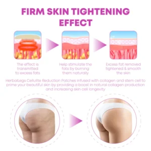 CelluFirm BodyTightening ThighWrap