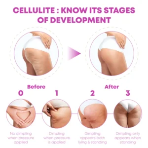 CelluFirm BodyTightening ThighWrap