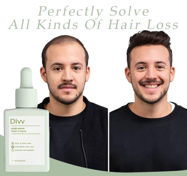 Divv™ Scalp Serum - Repair + Regrow Hair And Scalp