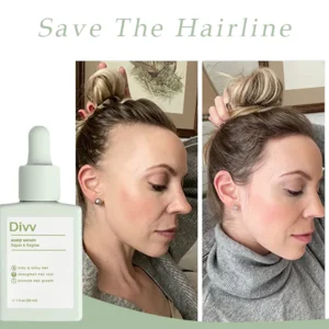 Divv™ Scalp Serum - Repair + Regrow Hair And Scalp