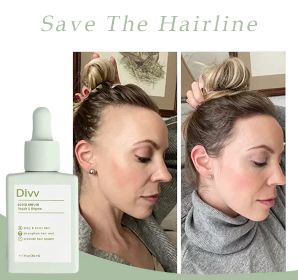 Divv™ Scalp Serum - Repair & Regrow