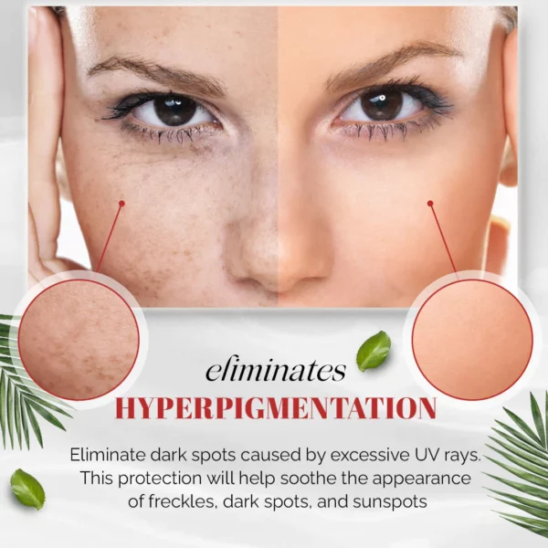 Effective Whitening Freckle Cream