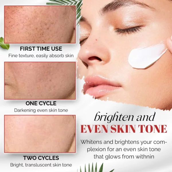 Effective Whitening Freckle Cream