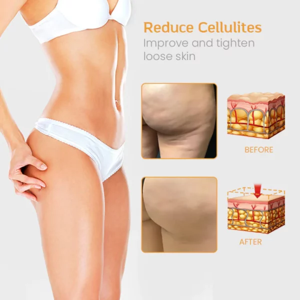 FitBod™ Anti-Cellulite Slimming Spray