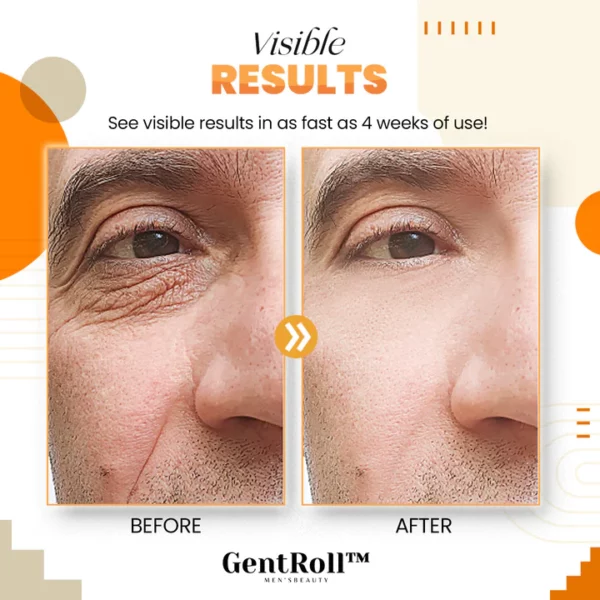 GentRoll™ Hyaluronic Acid Eyes Roller - Image 7