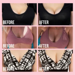 Invisible Bunny Lifting Bra