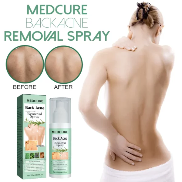 MEDCure BackAcne Removal Spray