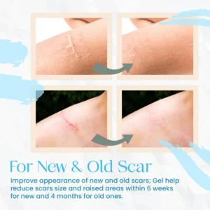 New Organic Scar Removing Gel