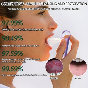 ORAL GUARD™ Mouth Bleeding-Mouth Ulcers-Oral Disease Treatment Spray