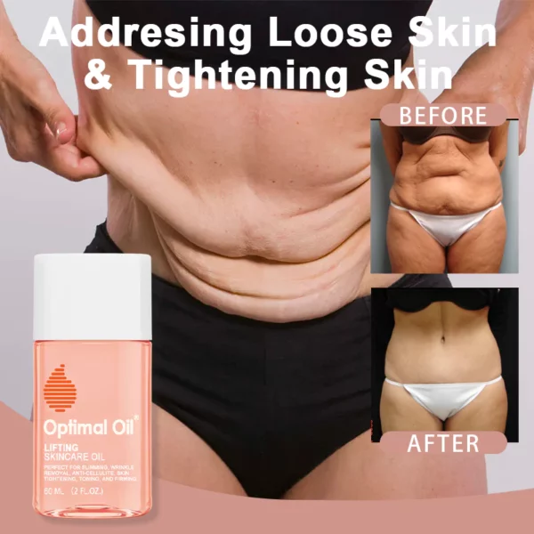 Optimal Oil®Collagen Boost Firming & Lifting Skincare Oil