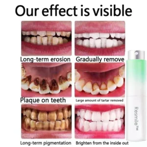 Resmile™ Pure Herbal Mouth Spray