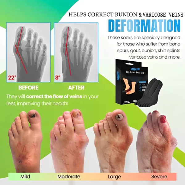 Sofeet™ Anti-Bunions Health Sock