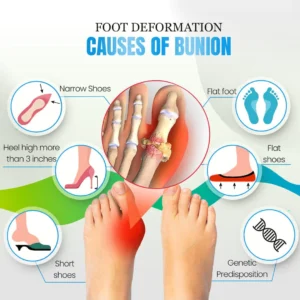 Sofeet™ Anti-Bunions Health Sock