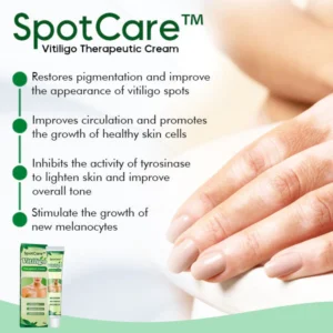 SpotCare™ Vitiligo Therapeutic Cream