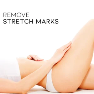 Stretch Mark Repairing Serum