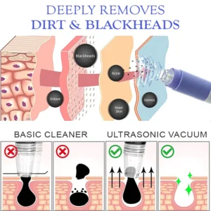 TOUCHBeauty Ultrasonic BlackheadRemover PoreVacuum