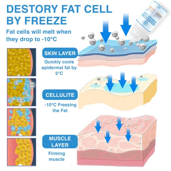 スノードロップホール Japan LPG Technology Cryolipolysis Cooler Gel