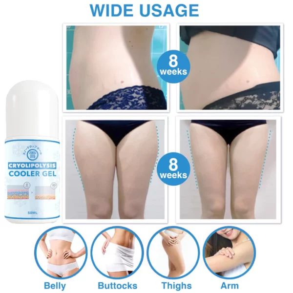 スノードロップホール Japan LPG Technology Cryolipolysis Cooler Gel