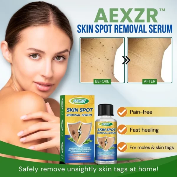 AEXZR™ Skin Spot Removal Serum - Image 3