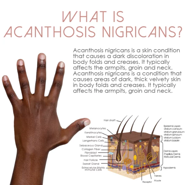 ATTDX Lightens AcanthosisNigricans TherapyOil