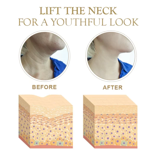 ATTDX PerfectNeck CollagenFirming LaceMask - Image 3