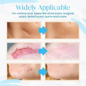 Advance Organic Scar Removing Gel