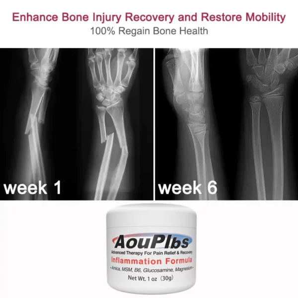 AouPlbs™ Joint & Bone Therapy Cream