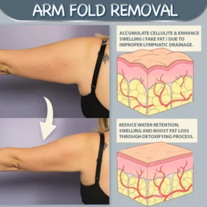 Armpit Fat Removal Lymphatic Pad