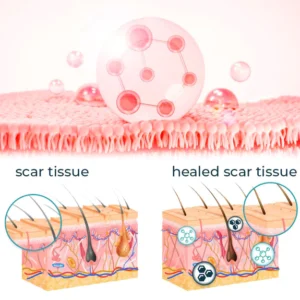 Bioskin™ Fortgeschrittenes Gel zur Narbenentfernung