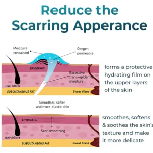 Bioskin™ Fortgeschrittenes Gel zur Narbenentfernung