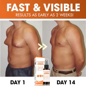 ChestFit™ Gynecomastia Fat Burner Spray