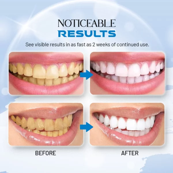 DazzleWhite Teeth Whitening Essence