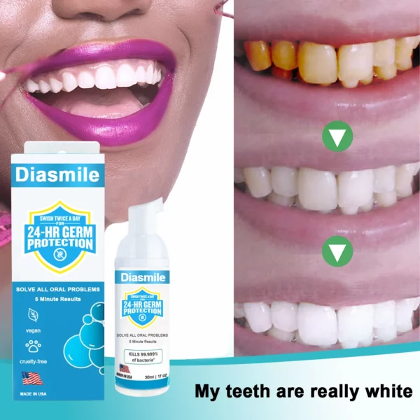 Diasmile™ Pure Herbal Super Whitening Teeth & Mouth Repair Foam - Image 5