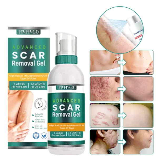 Fivfivgo™ ScarRemove Advanced Scar Spray