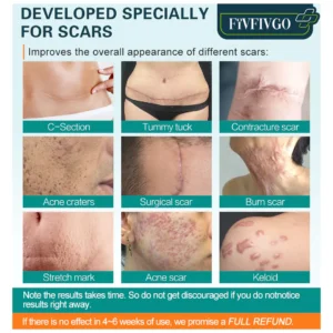 Fivfivgo™ ScarRemove Advanced Scar Spray