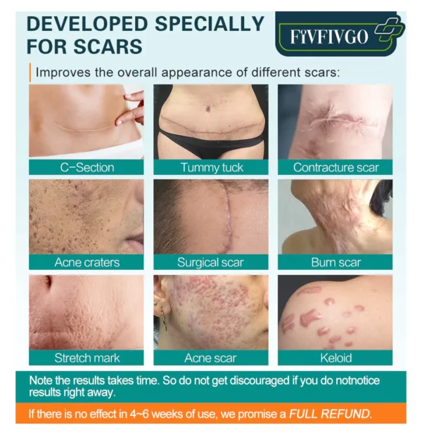 Fivfivgo™ ScarRemove Advanced Scar Spray