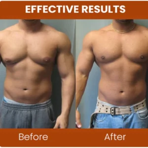 Gynecomastia Chest Tightening Spray