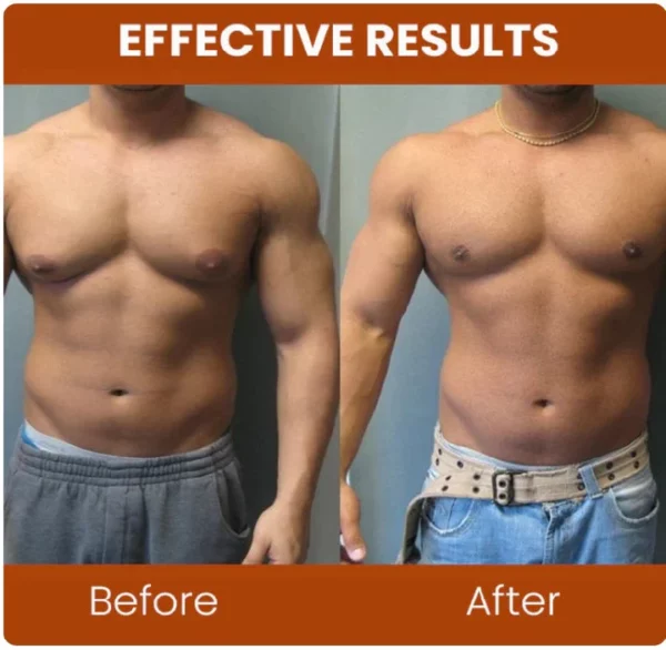 Gynecomastia Chest Tightening Spray