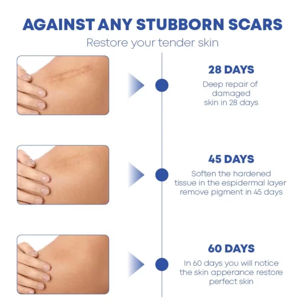 MEDVMA NonSurgical ScarRemoval SiliconTape