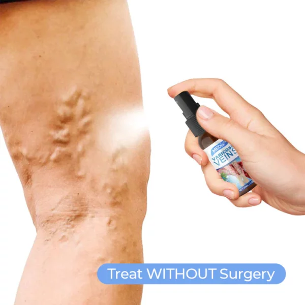 MEDix™ Vein Care Fading Spray - Image 3