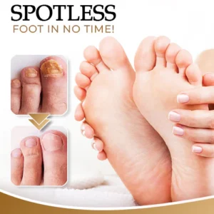 NailCure™ Anti-Fungal Foot Spray