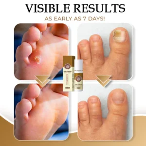 NailCure™ Anti-Fungal Foot Spray