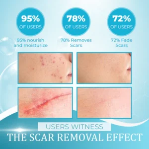 OrgPurePro™ Organic Scar Removing Gel