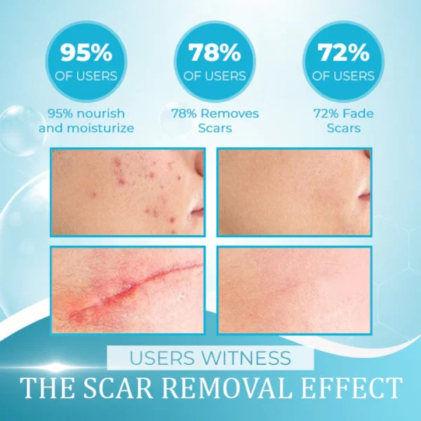 OrgPurePro™ Organic Scar Removing Gel