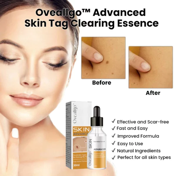 Oveallgo™ Advanced Skin Tag Clearing Essence - Image 4