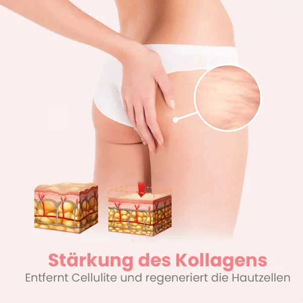 Oveallgo™ BootyBoost AntiAkne Peeling Natürliche Seife